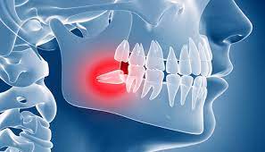 oral