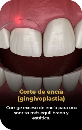 Grupo 25 copia 3